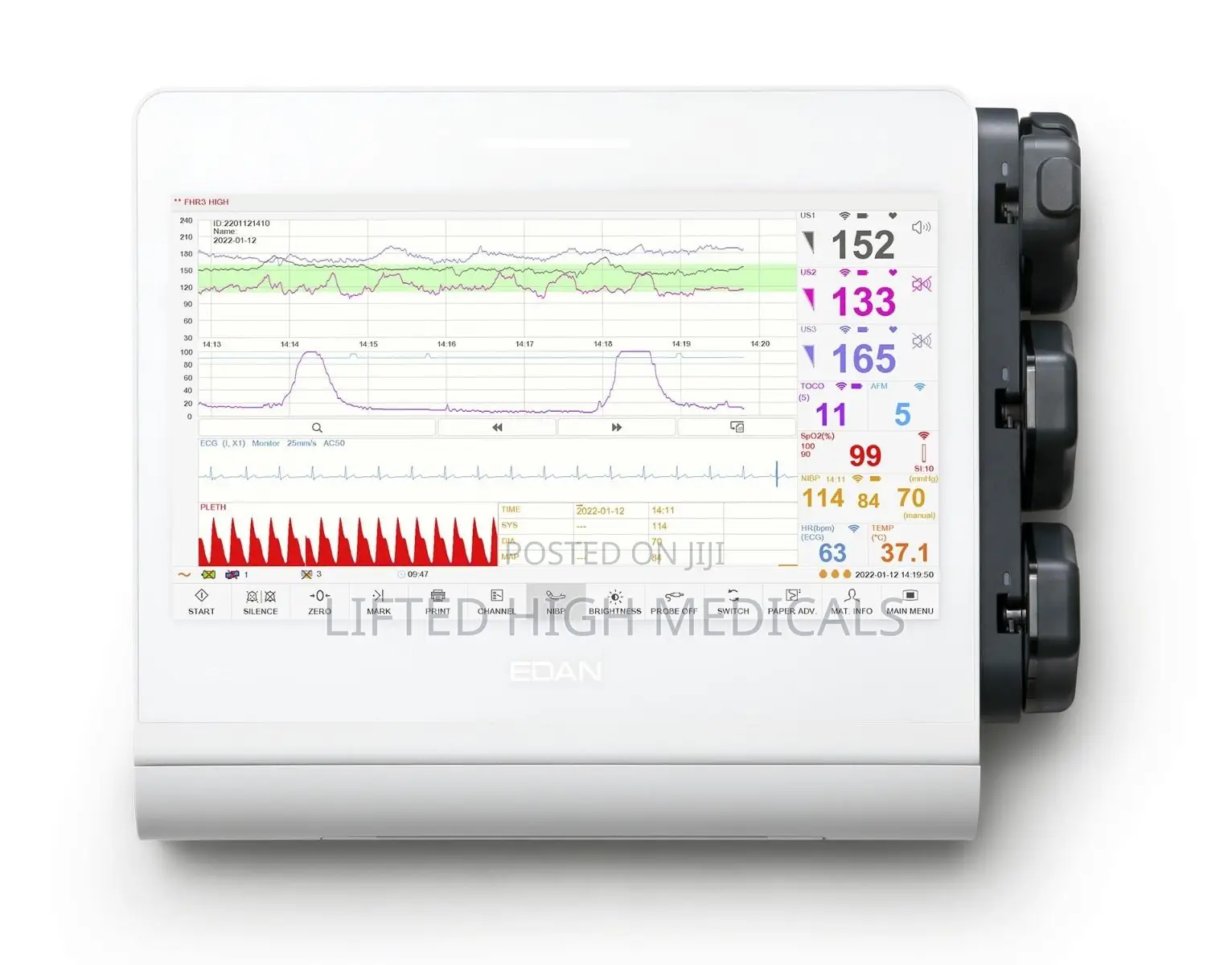 Edan F12 CTG Fetal Monitor for Maternity Labor Wards