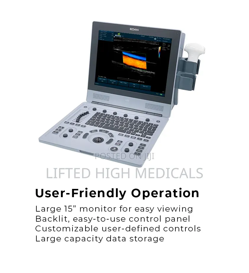 Edan U60 Color Doppler Ultrasound Machine