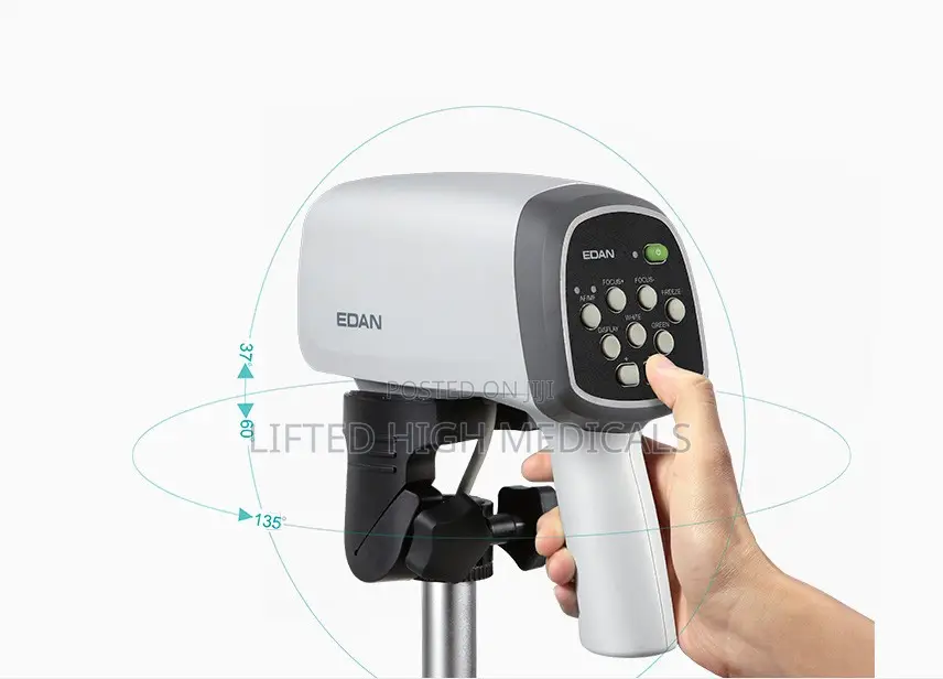 Edan C6hd Digital Video Colposcope for Gynecology