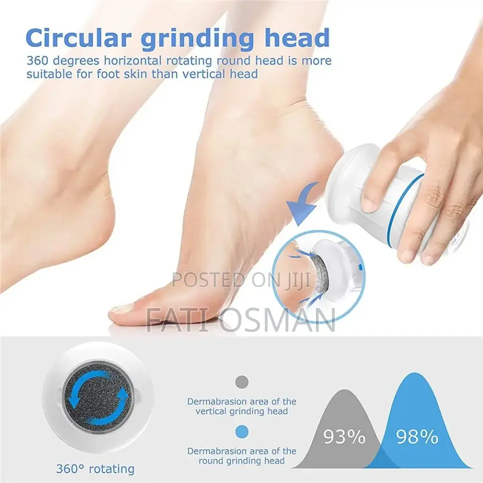 Callus Remover