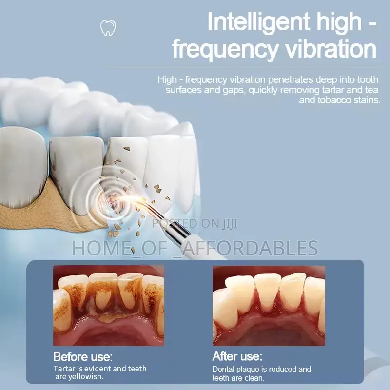 Adult Electric Toothbrush / Plaque Remover