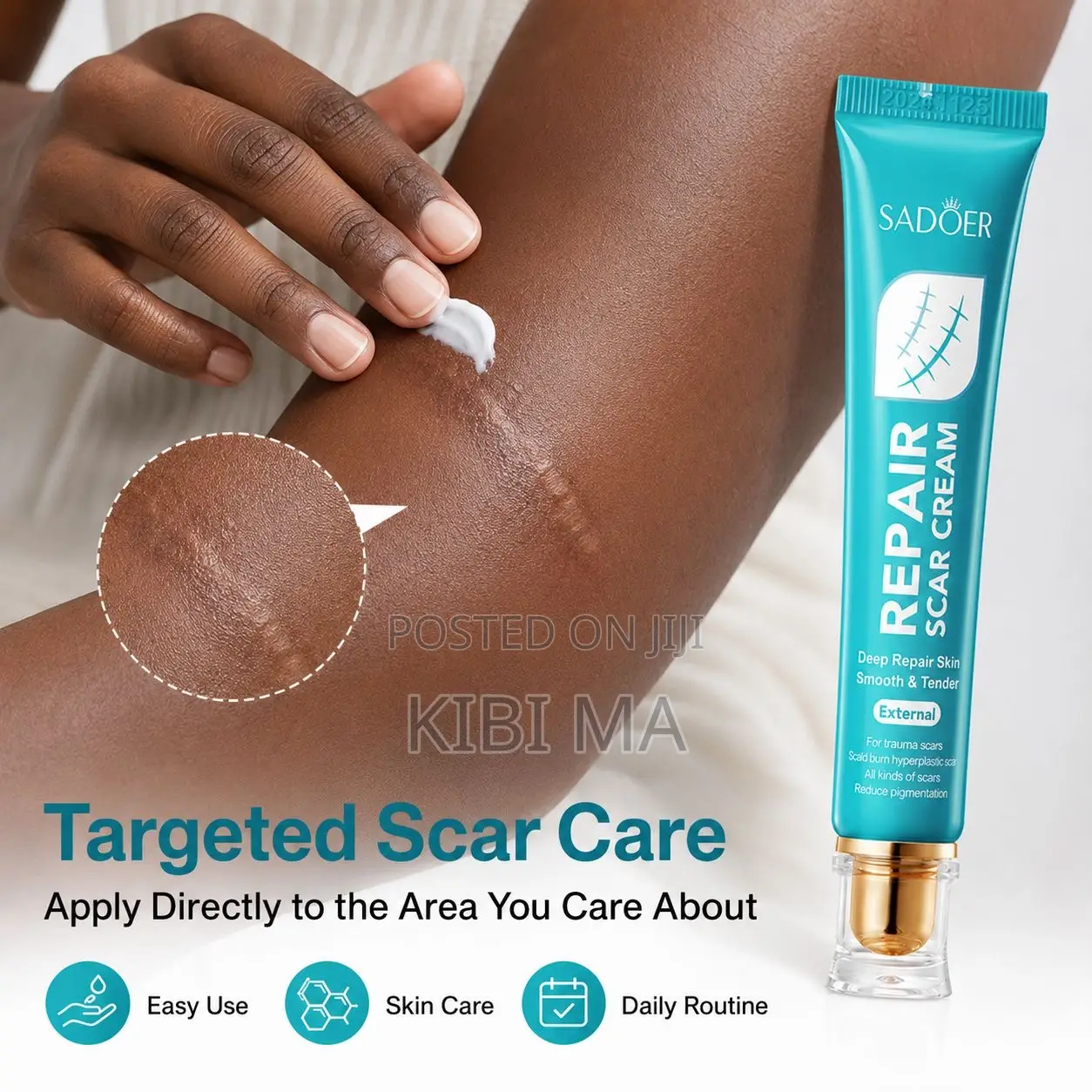 Scar Removal Cream