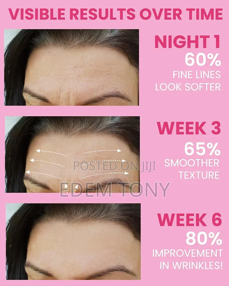Akissos Facial Wrinkle Patches 80pcs Update Version