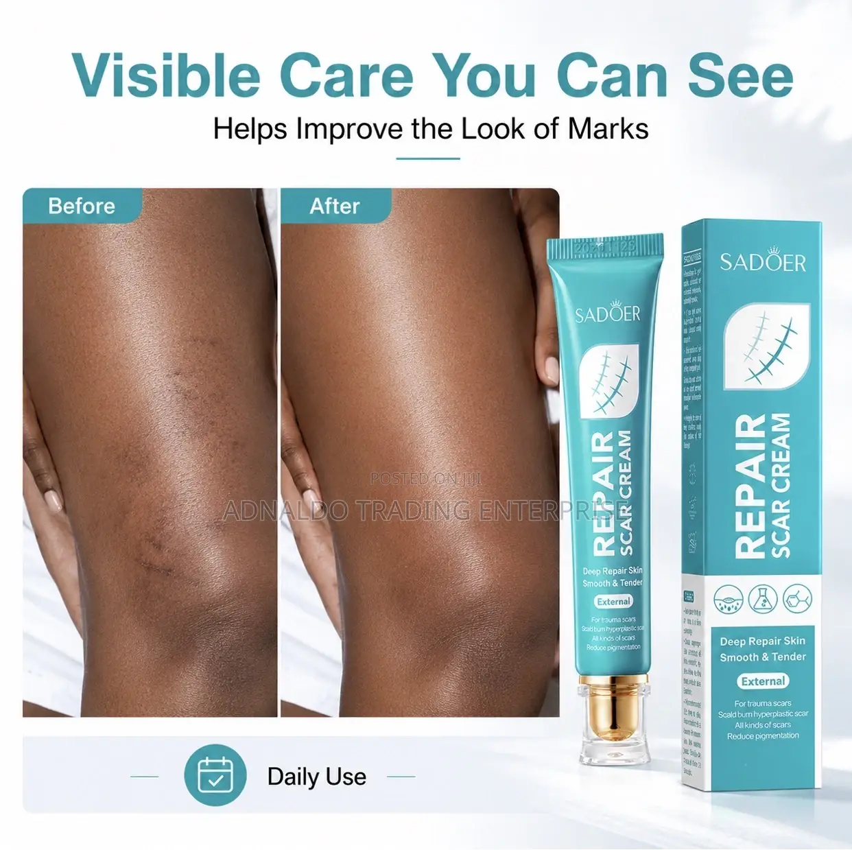 Scar Removal Cream