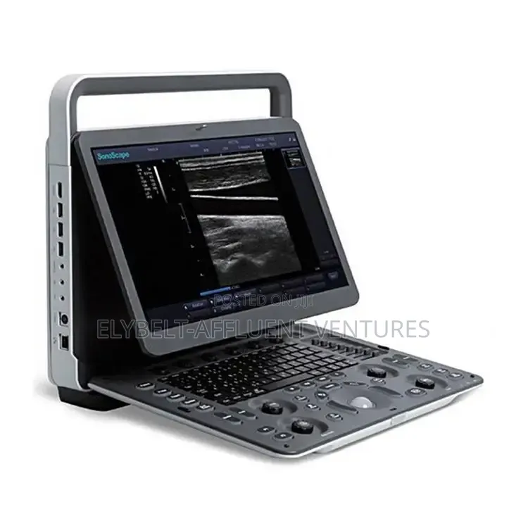 Sonoscape E2 Color Doppler Ultrasound Machine