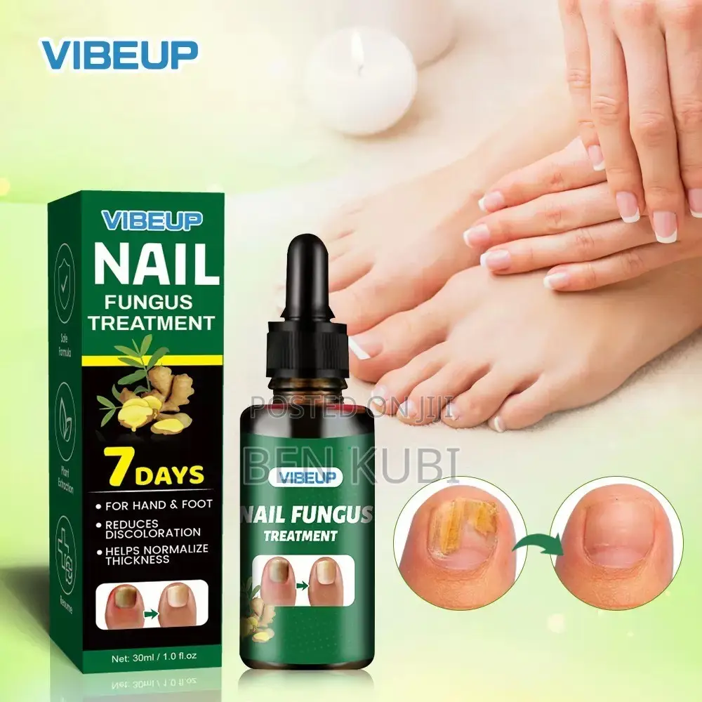 Nail Fungus Treatment