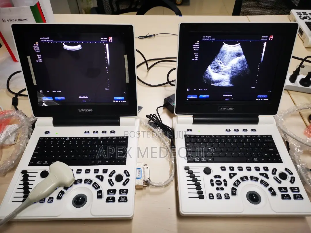 Brandnew SonoTec Portable Ultrasound Scan Machine + 1 Convex Probe
