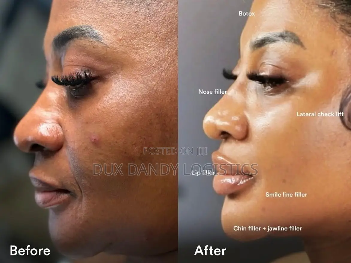 Dark Spot Corrector