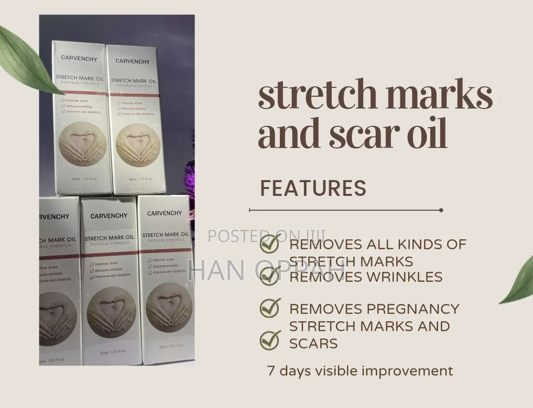 Strechmark Oil