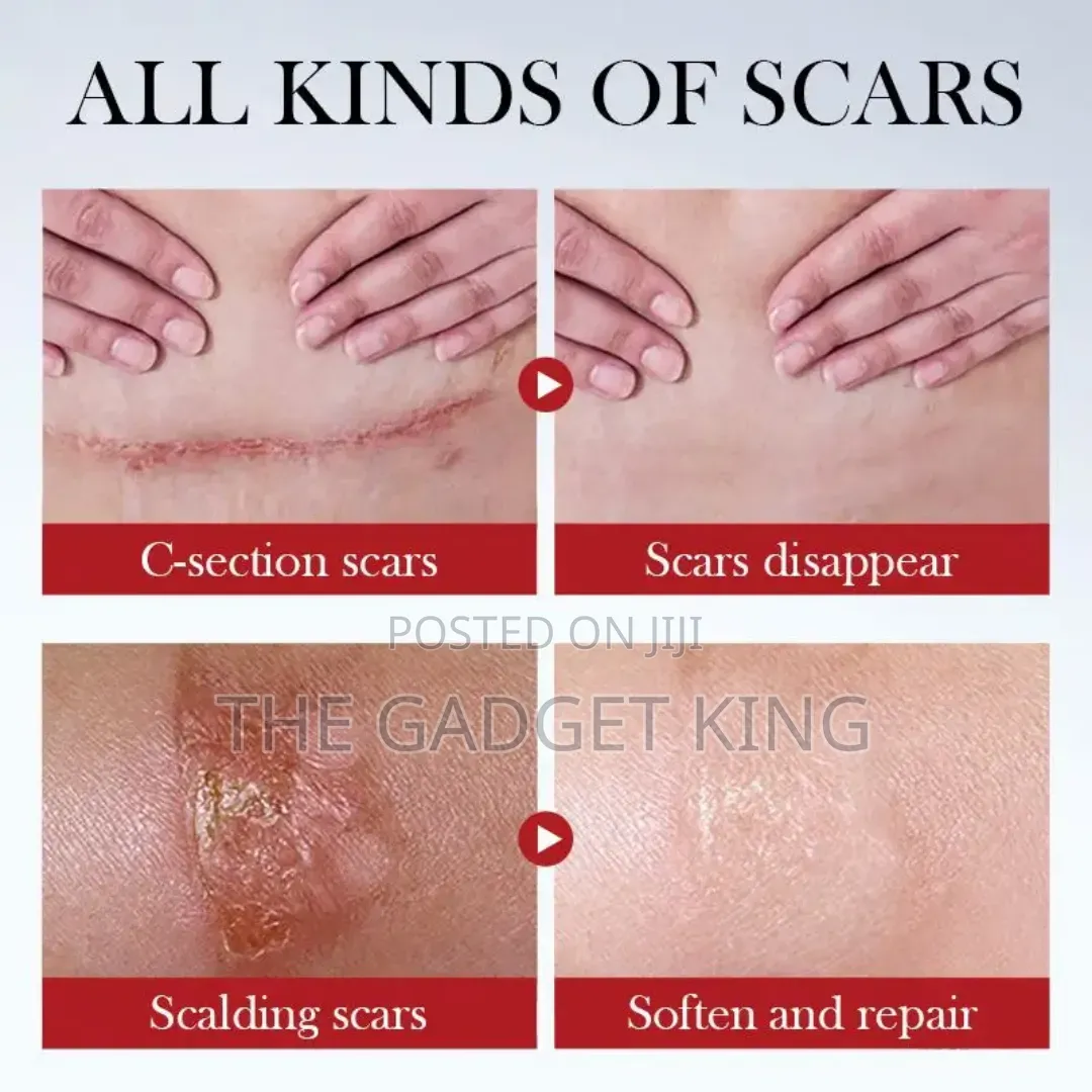 Scar Cream