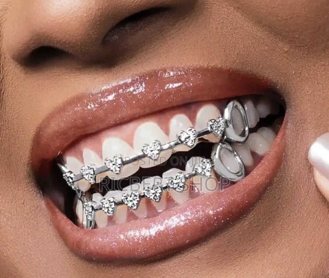 Teeth Grillz Braces