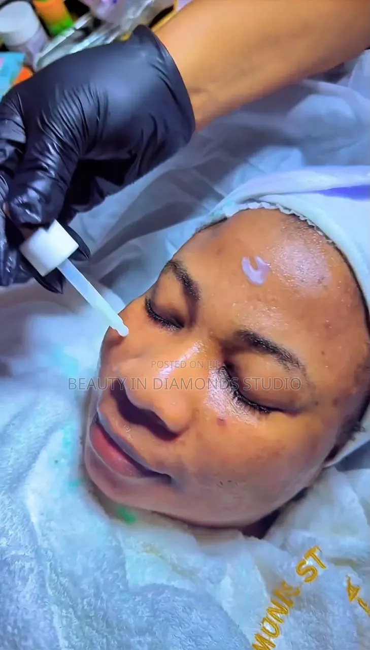 Anti Acne Treatment
