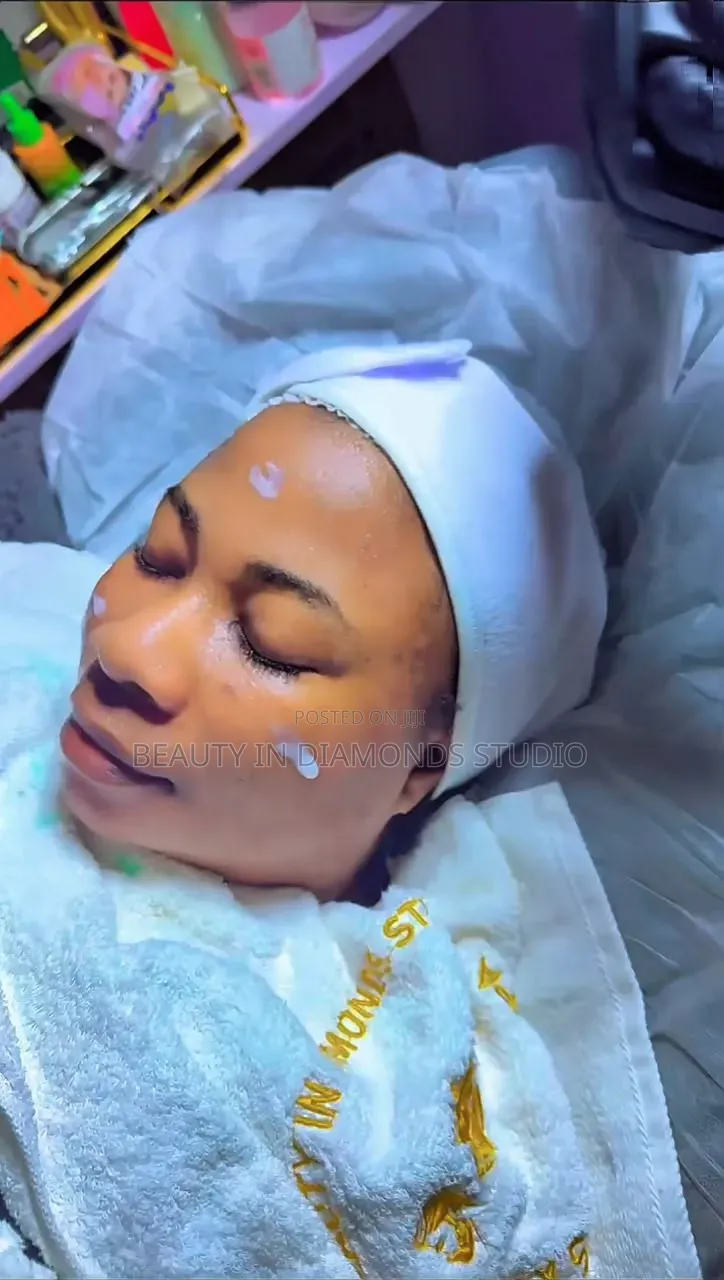 Anti Acne Treatment