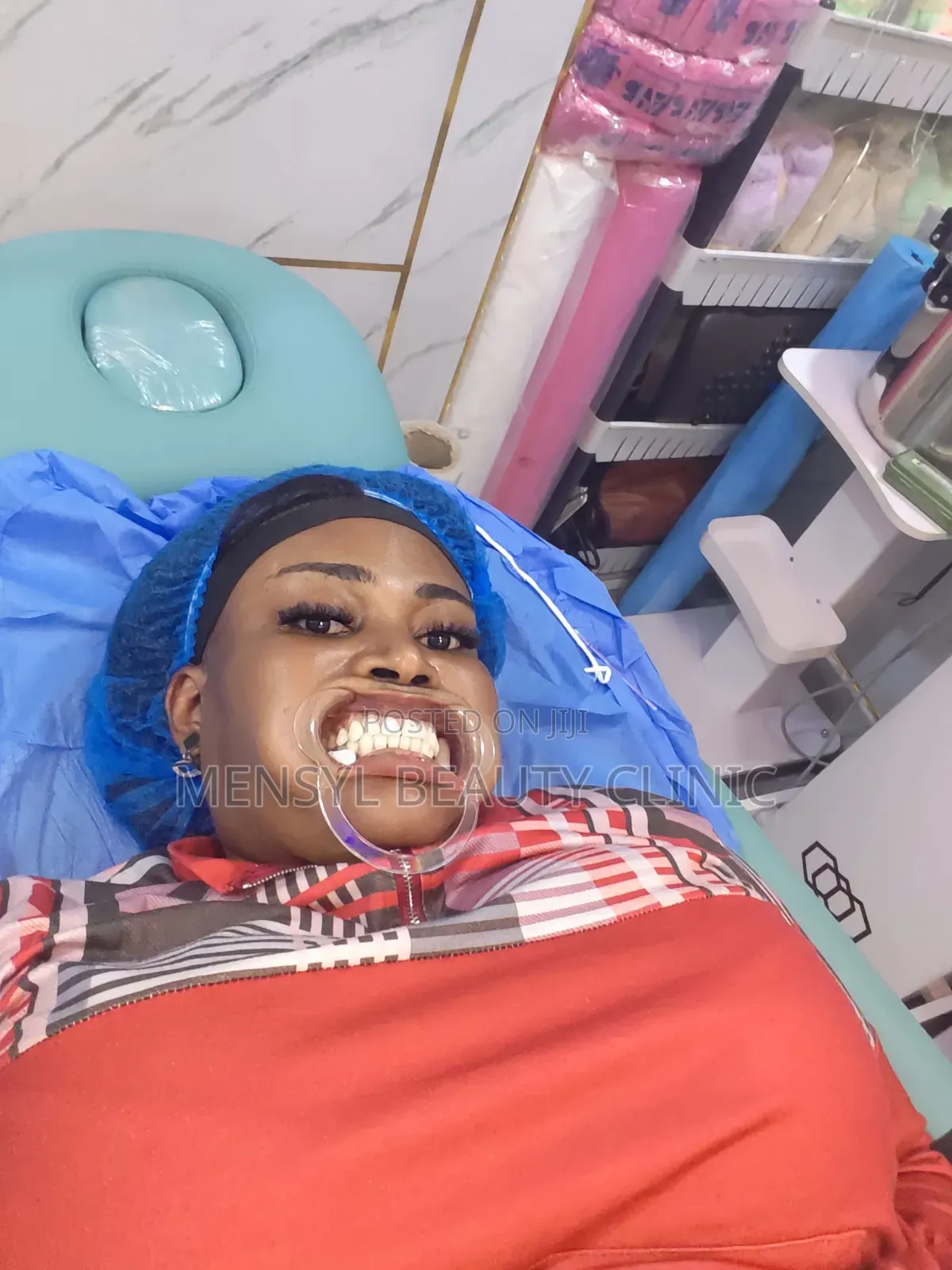 Professional Teeth Whitening