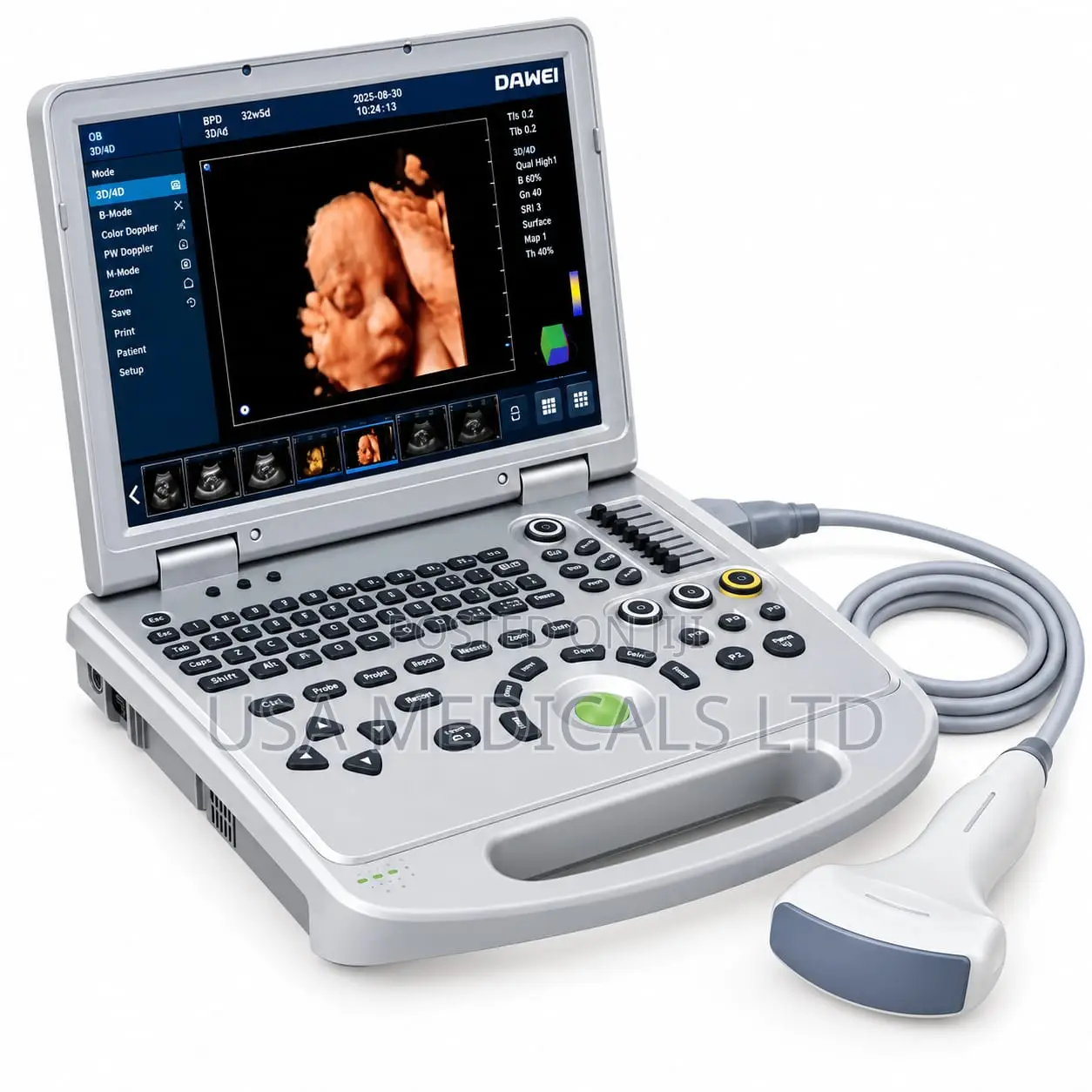 Ultrasound Scan Trolley With Convex Probe(DAWEI)