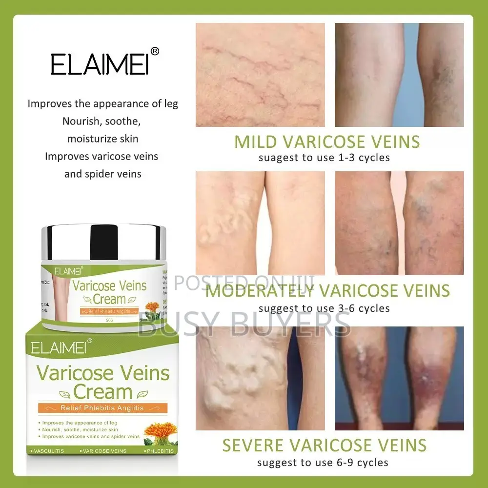Varicose Veins Cream(ELAME)