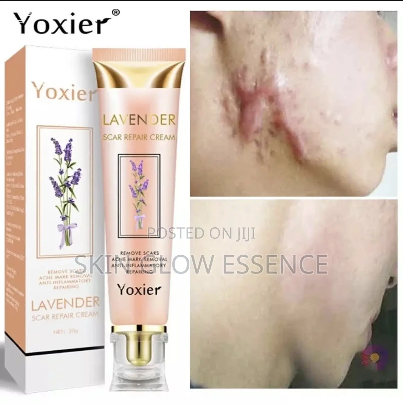 Yoxier Scar Remover