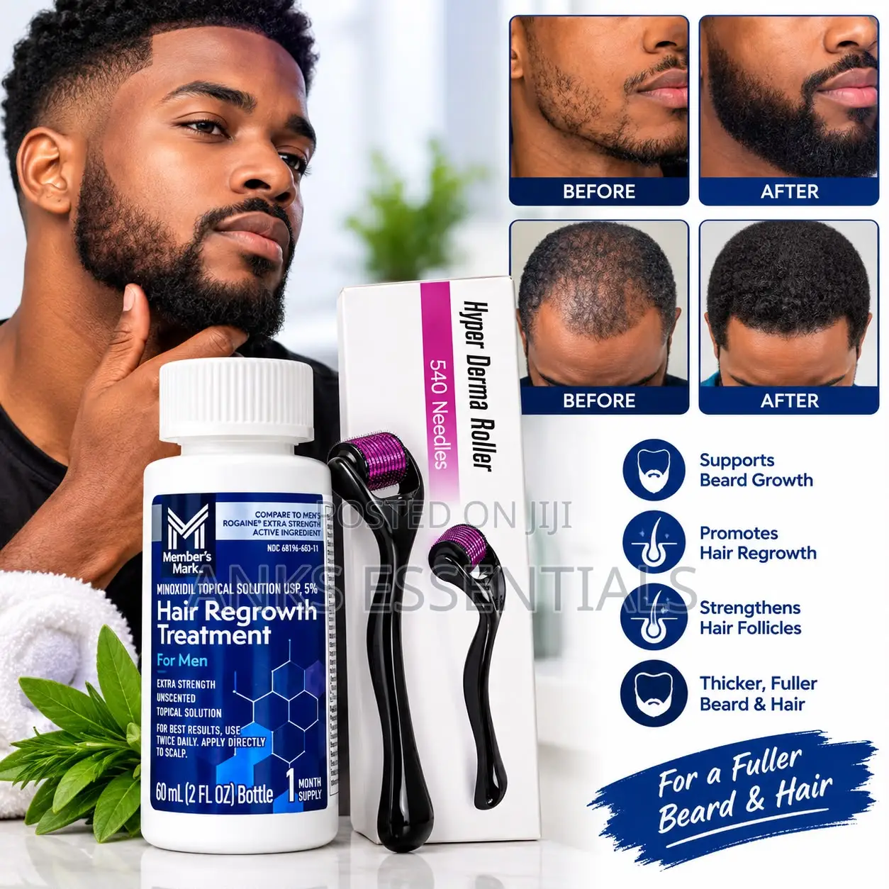 Member’s Mark Minoxidil 5% Hair Care Set for Men