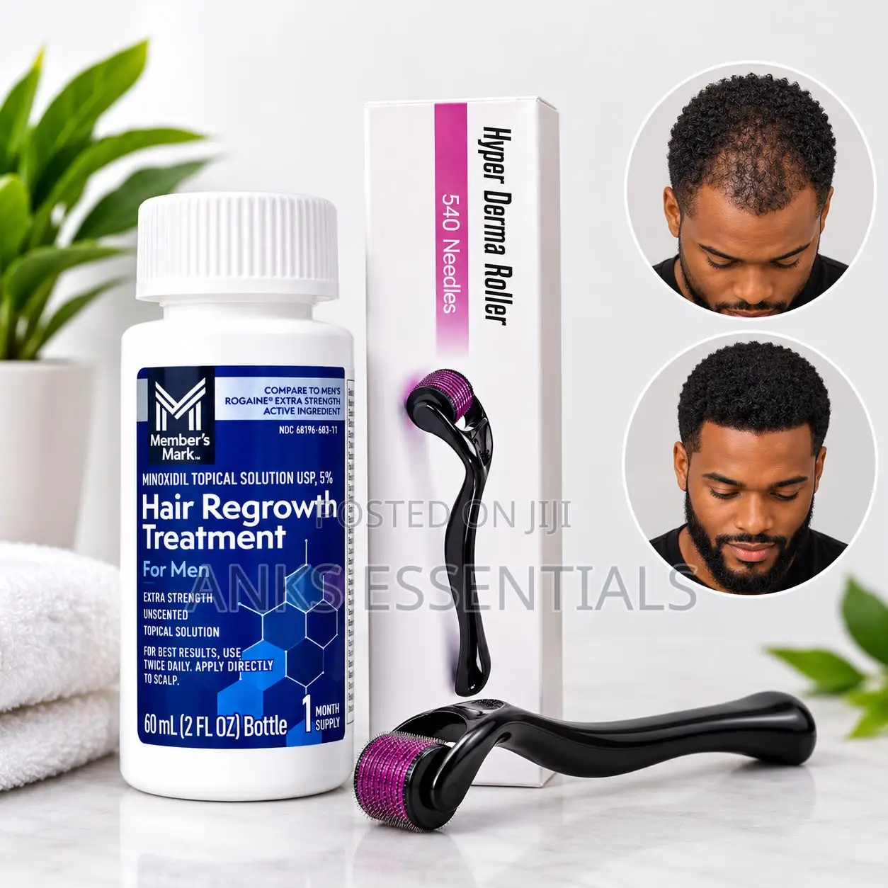 Member’s Mark Minoxidil 5% for Men