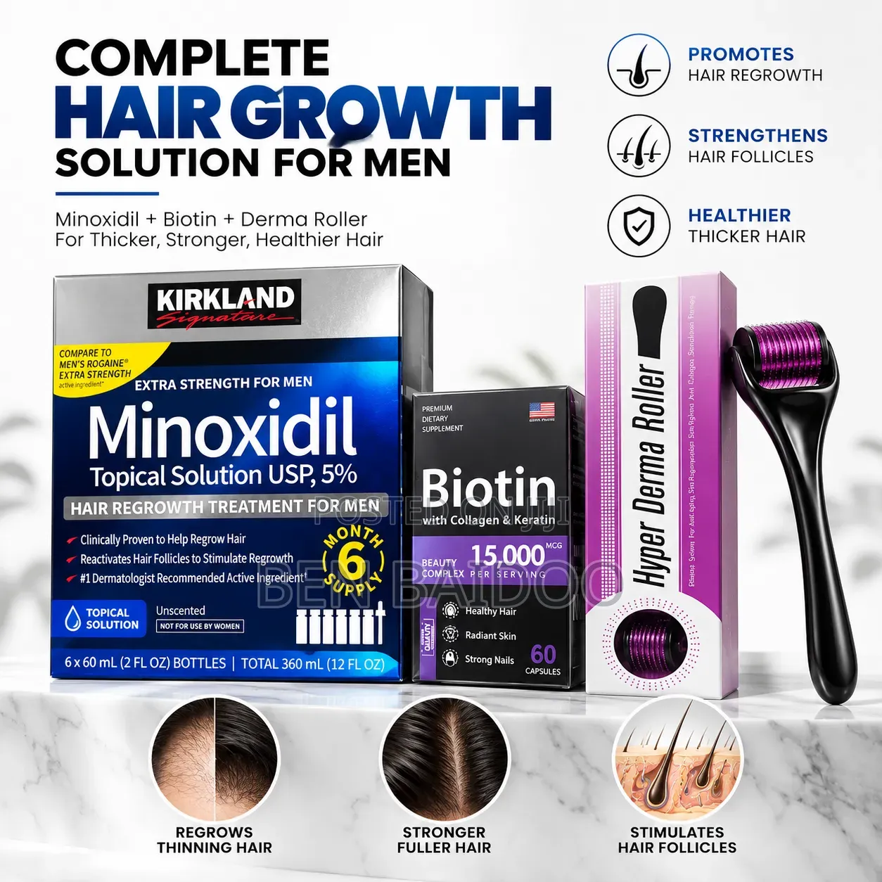 Kirkland Minoxidil Pack+Derma Roller+Biotin (Complete Solution)